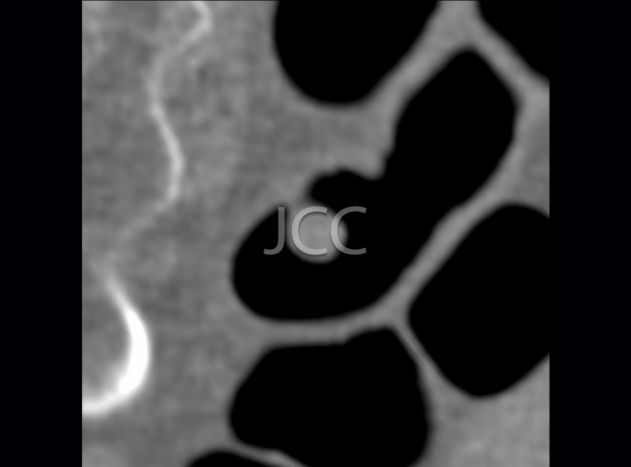 jcc_17_colon.jpg