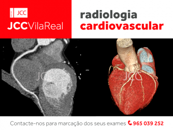 You can now do your Cardiac CT in Vila Real